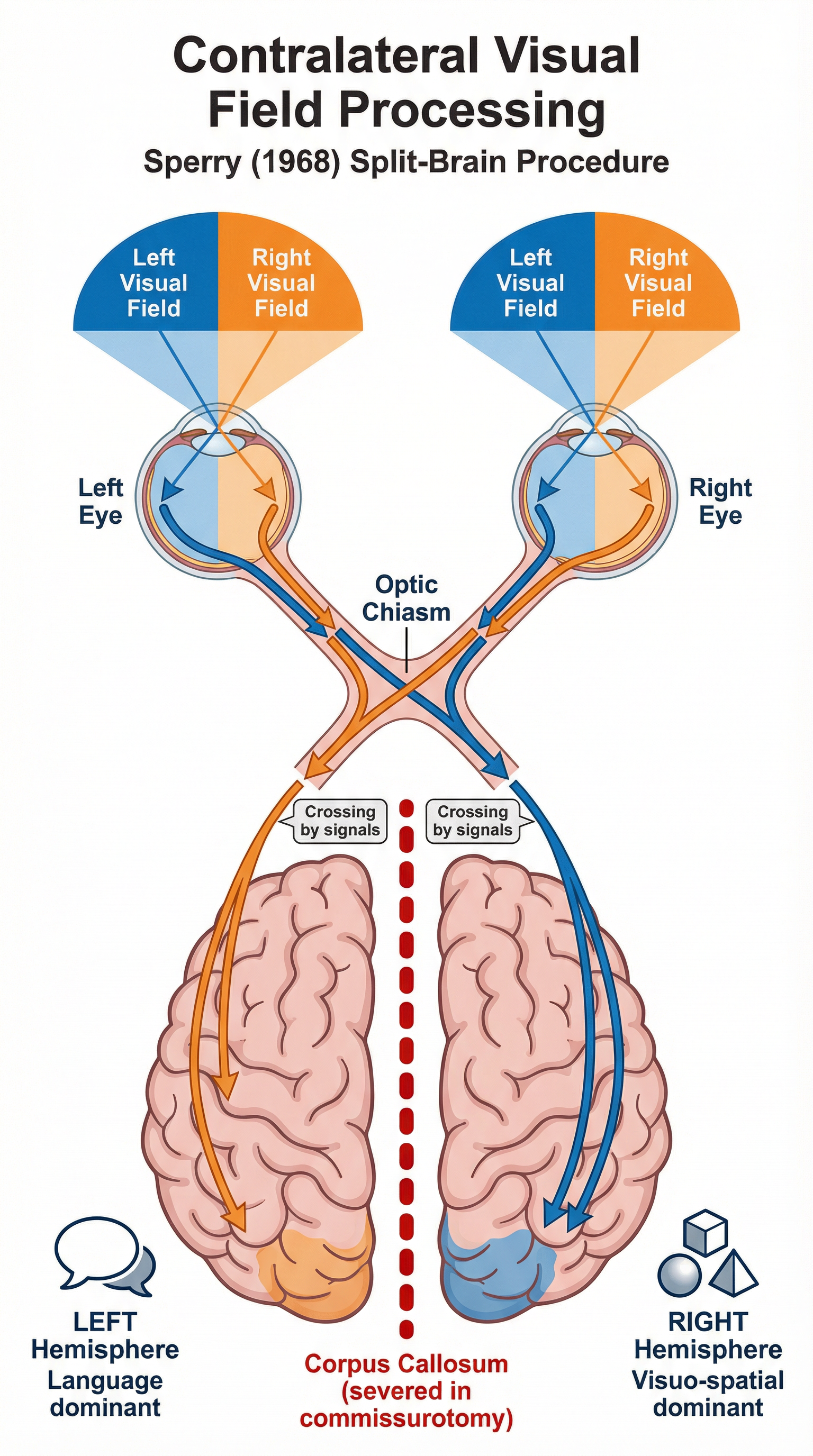 Diagram of Contralateral Visual Field Processing