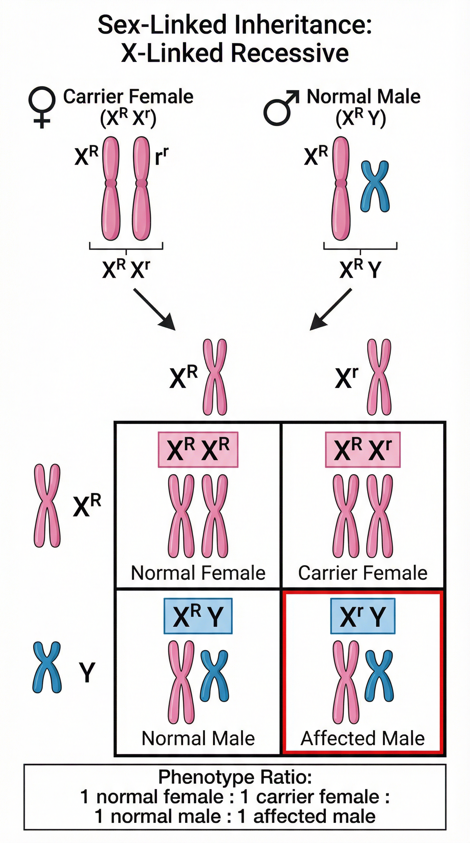 A Punnett square demonstrating the inheritance of an X-linked recessive condition.