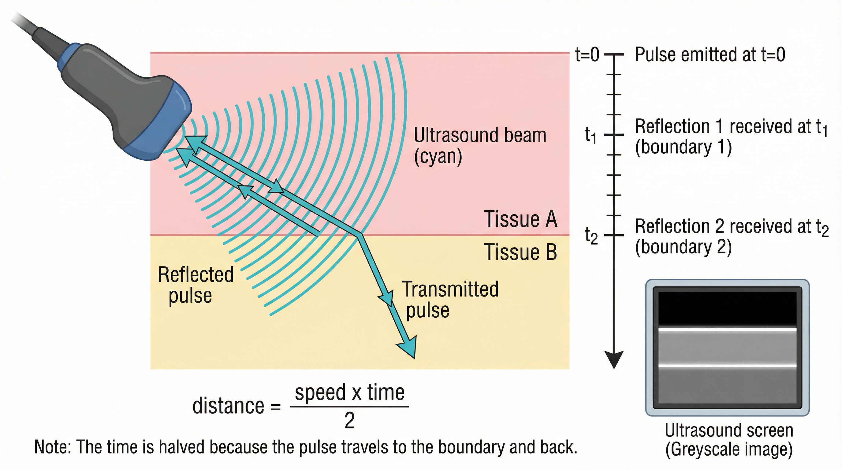 The principle of medical ultrasound imaging.
