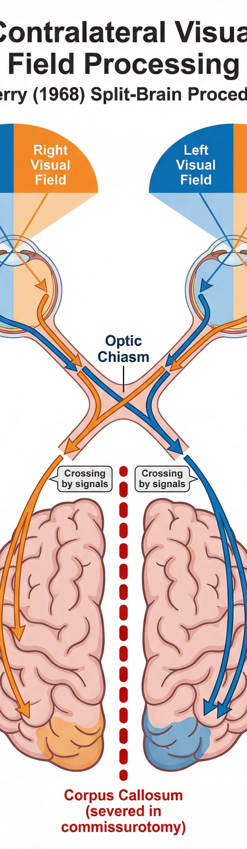 Diagram of Contralateral Visual Field Processing