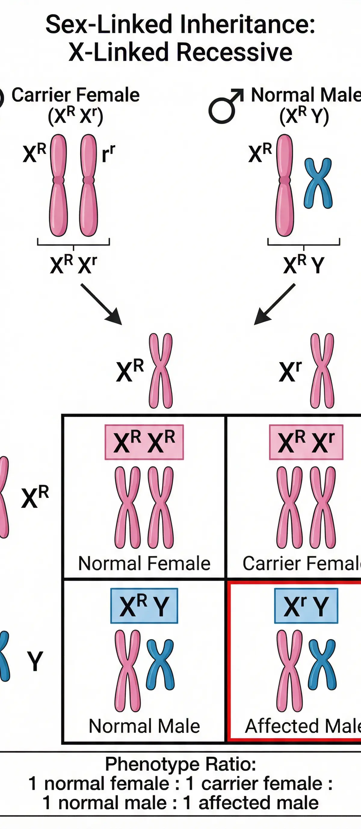 A Punnett square demonstrating the inheritance of an X-linked recessive condition.