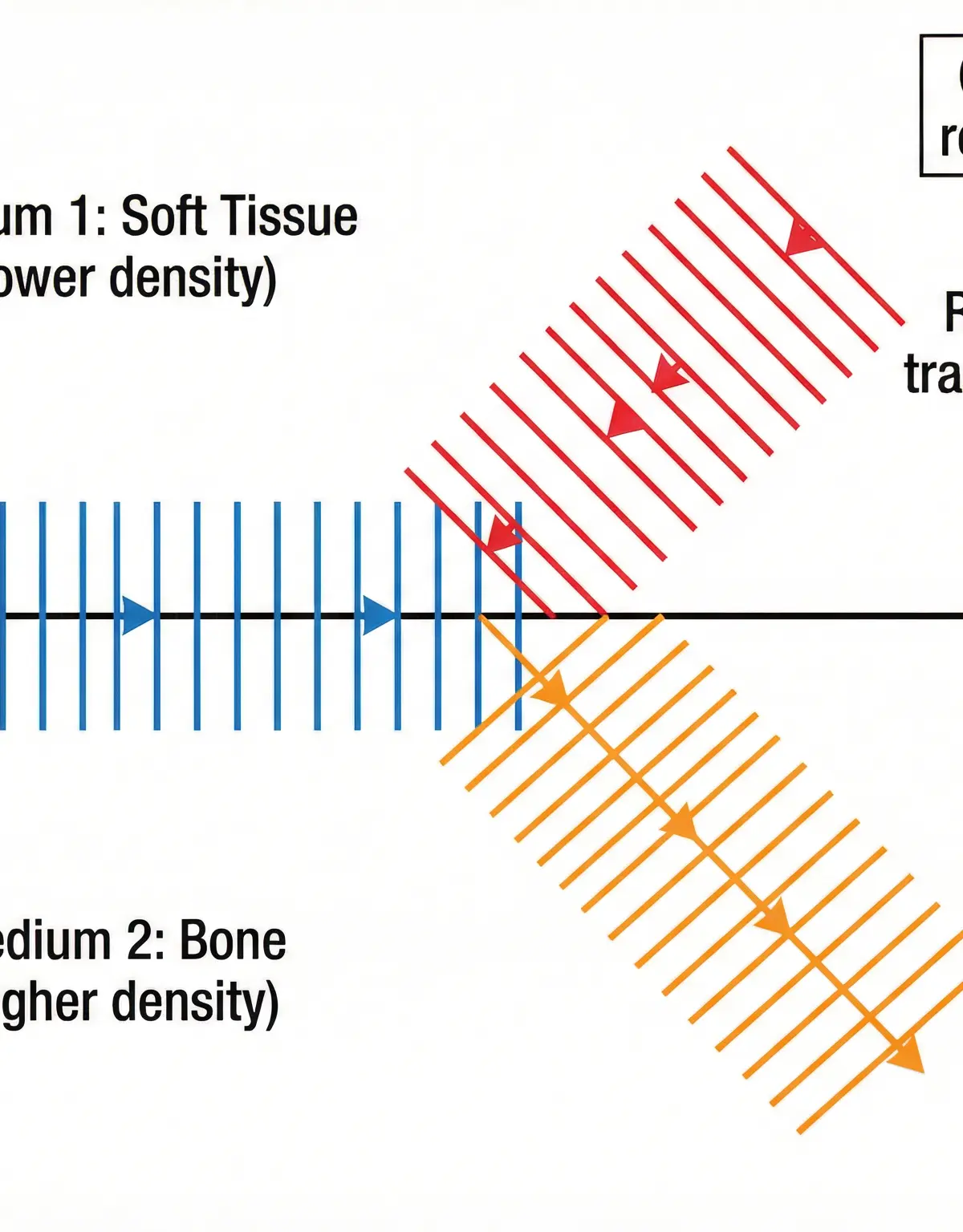 Partial reflection at a tissue boundary: only SOME of the wave reflects back to the probe